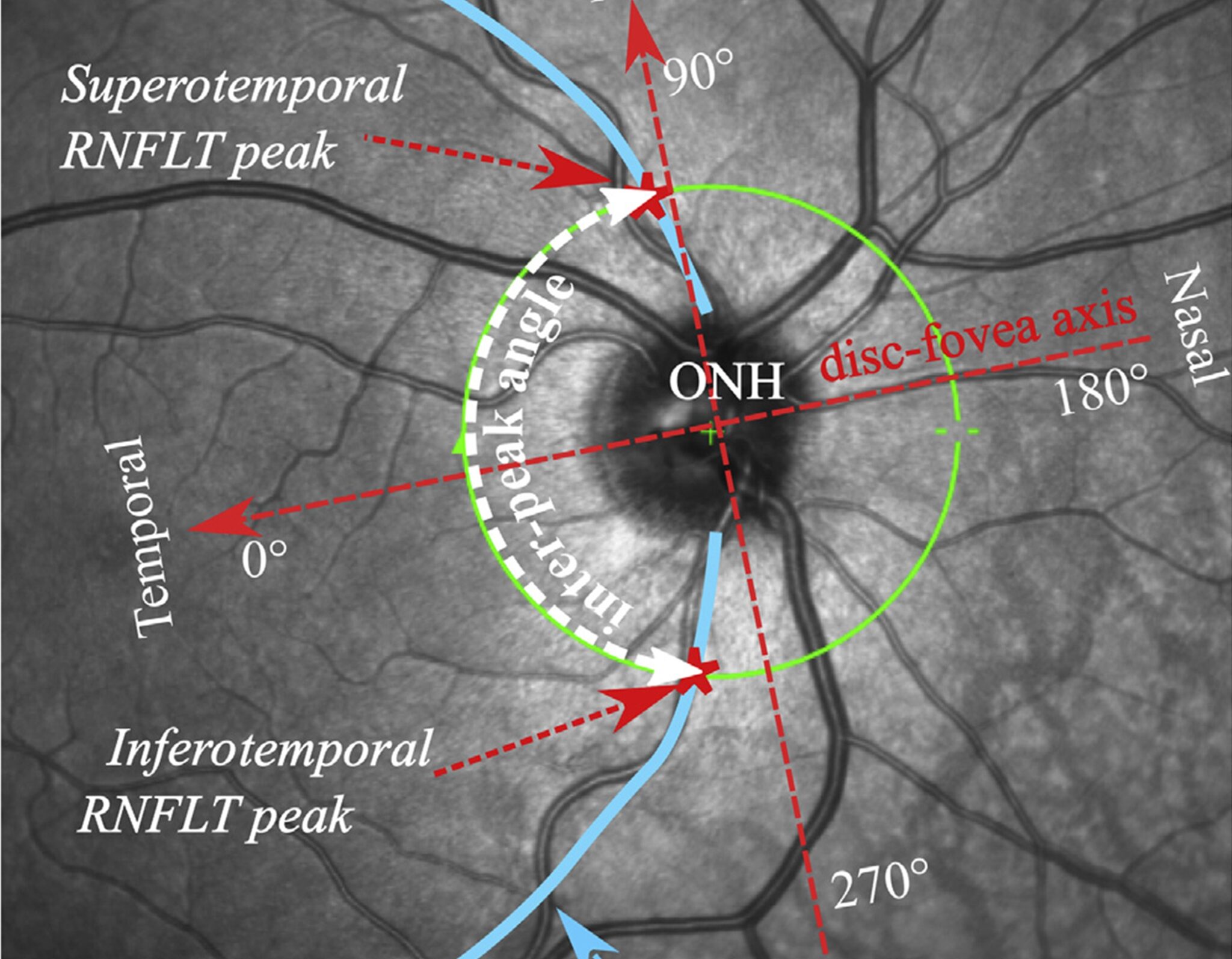 Home - Harvard Ophthalmology AI Lab